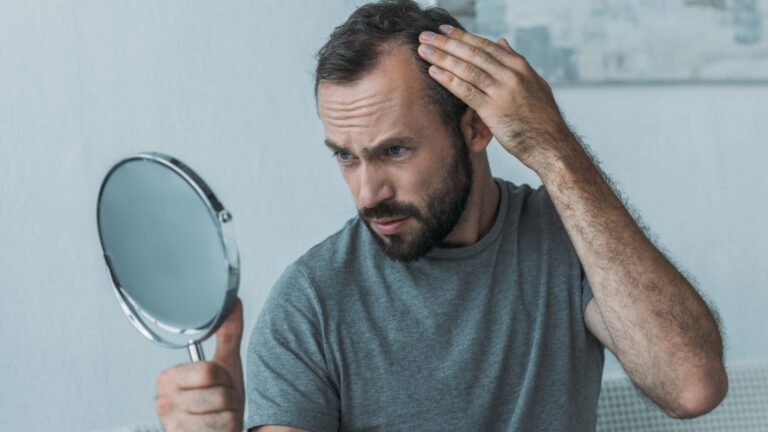 Haarausfall bei Männern – Bluttest zur Ursachenabklärung