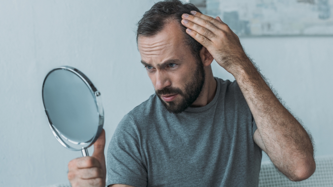Haarausfall bei Männern – Bluttest zur Ursachenabklärung